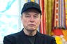 Musk explains black eye as he sports shiner during meeting with Trump
