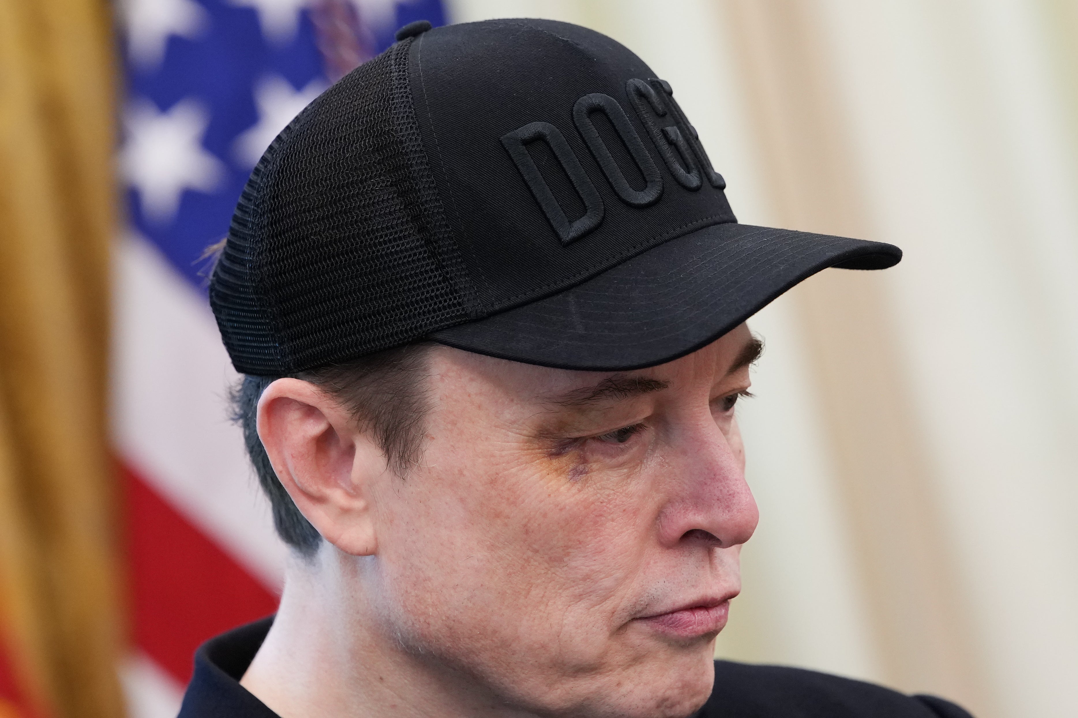 Musk claimed he got a black eye after his 5-year-old son punched him in the face.