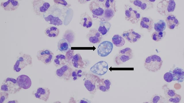<p>An elderly woman from Texas has died after contacting a brain-eating ameba from rinsing her sinuses, the Centers for Disease Control said</p>
