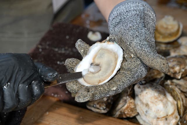 <p>Whether the upcoming norovirus season will surge early again this year may be anyone’s guess. But, scientists say there’s a new strain to worry about</p>