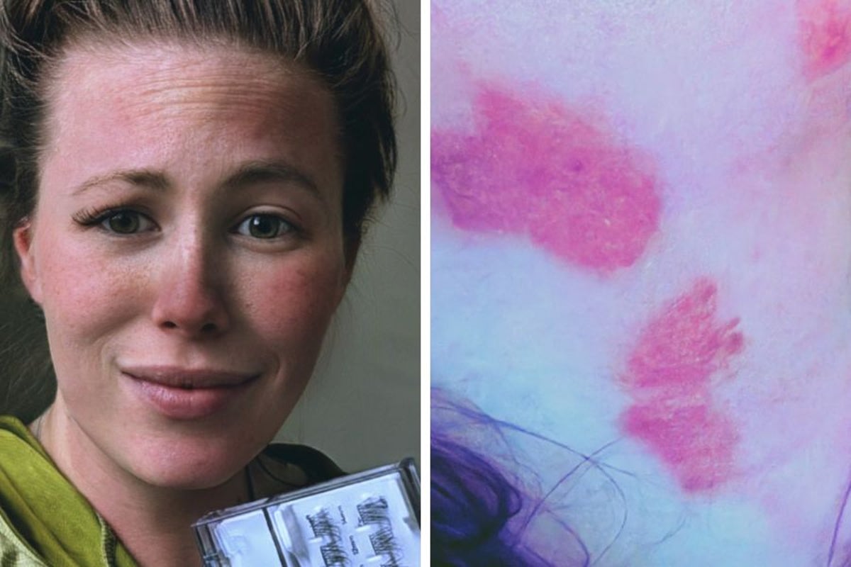Mom ‘engulfed in flames’ and suffered burns to 48% of her body in horrific smoker BBQ explosion