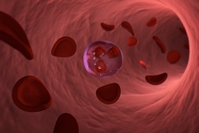 <p>The new treatment could halt the progression of myeloma, a blood cancer that affects plasma cells</p>