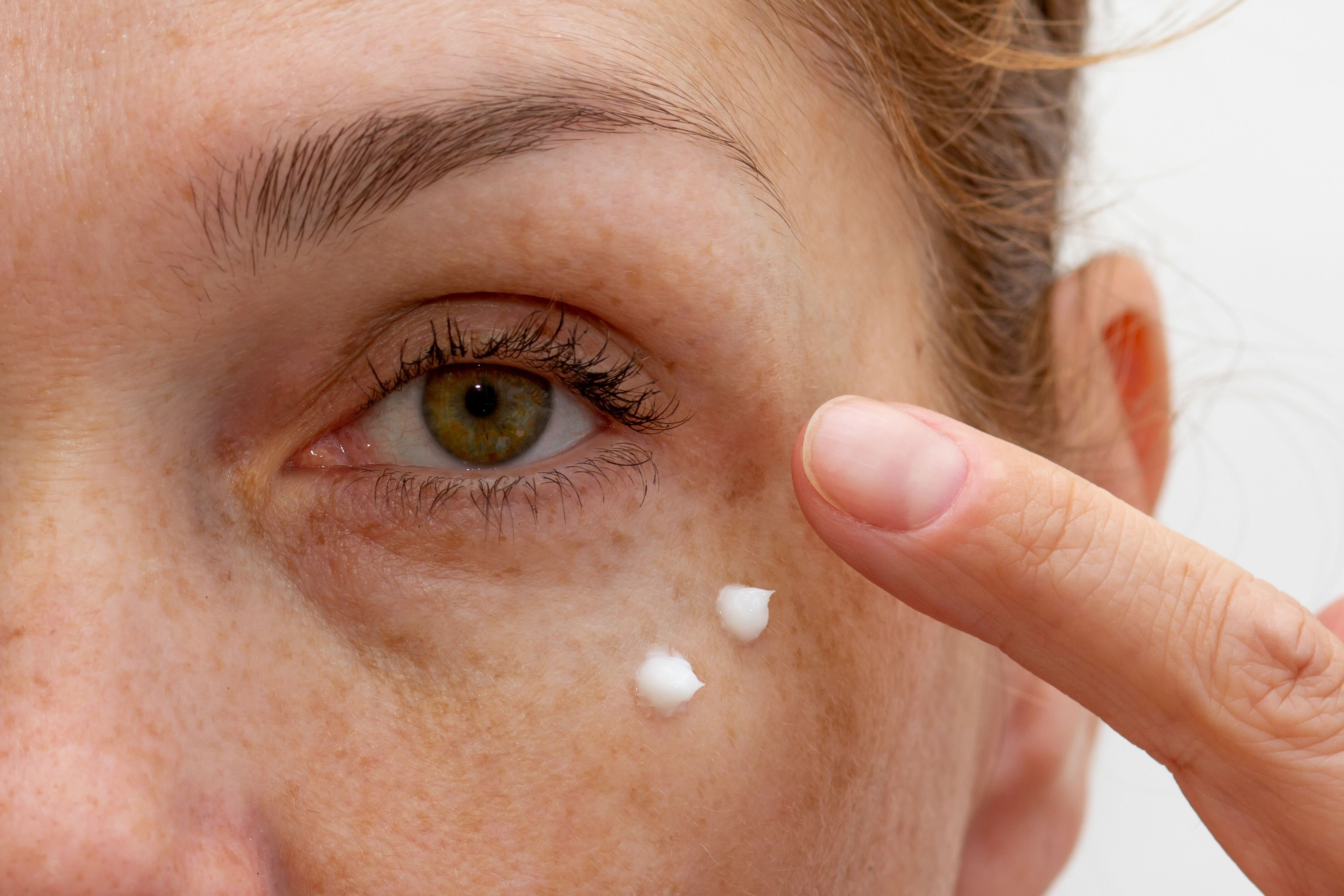 A dermatologist says this medical-grade eye cream makes dark circles ‘noticeably brighter’