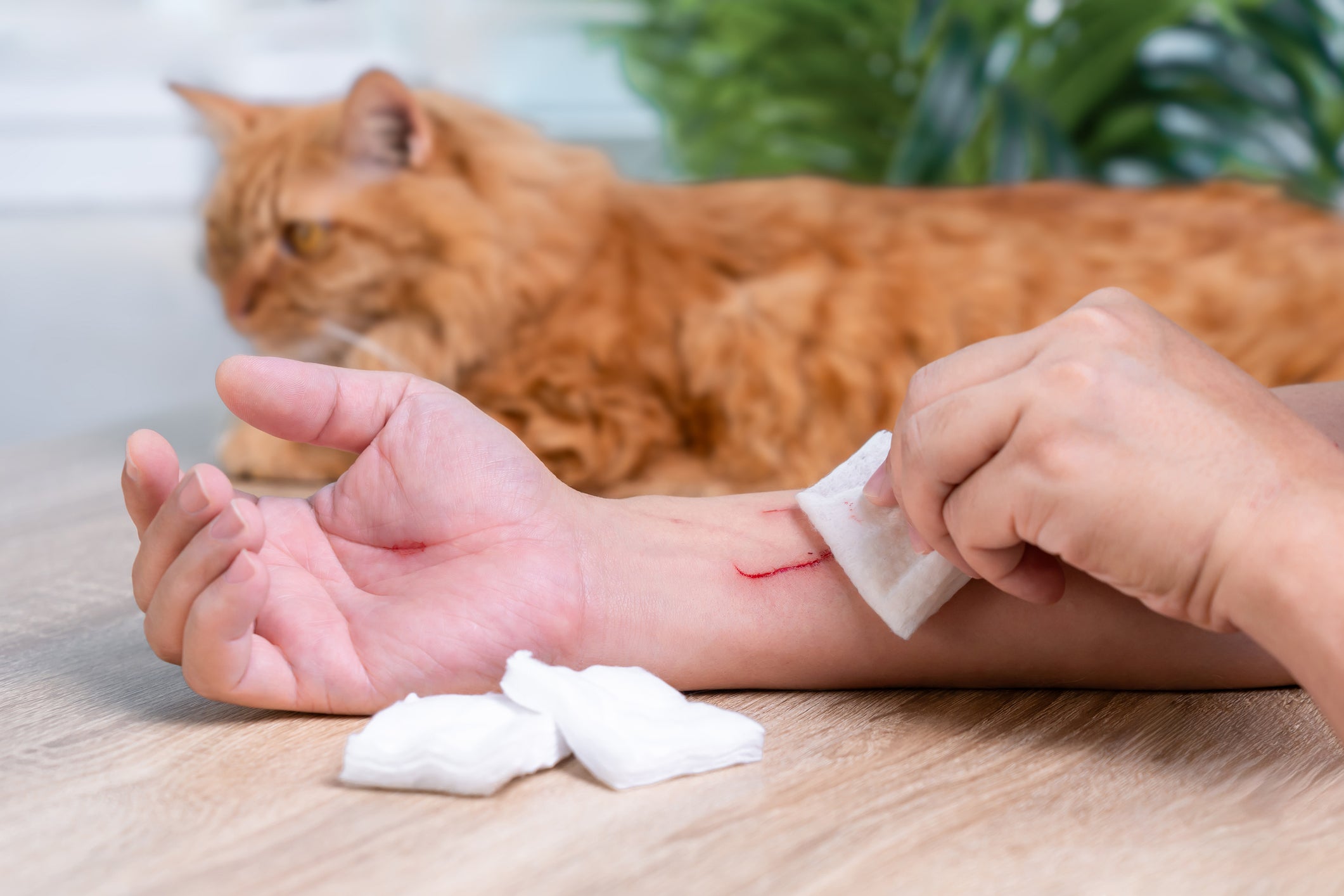 The rage is transmitted by injuries such as the bites and scratches of an infected animal.