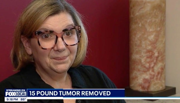 Julie Camarillo of Michigan traveled 300 miles to have an over 15-pound tumor removed from her stomach after doctors at home refused to operate