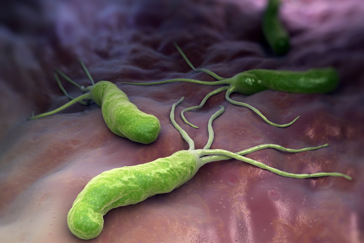 Gut bacteria may hold key to protecting brain against Alzheimers