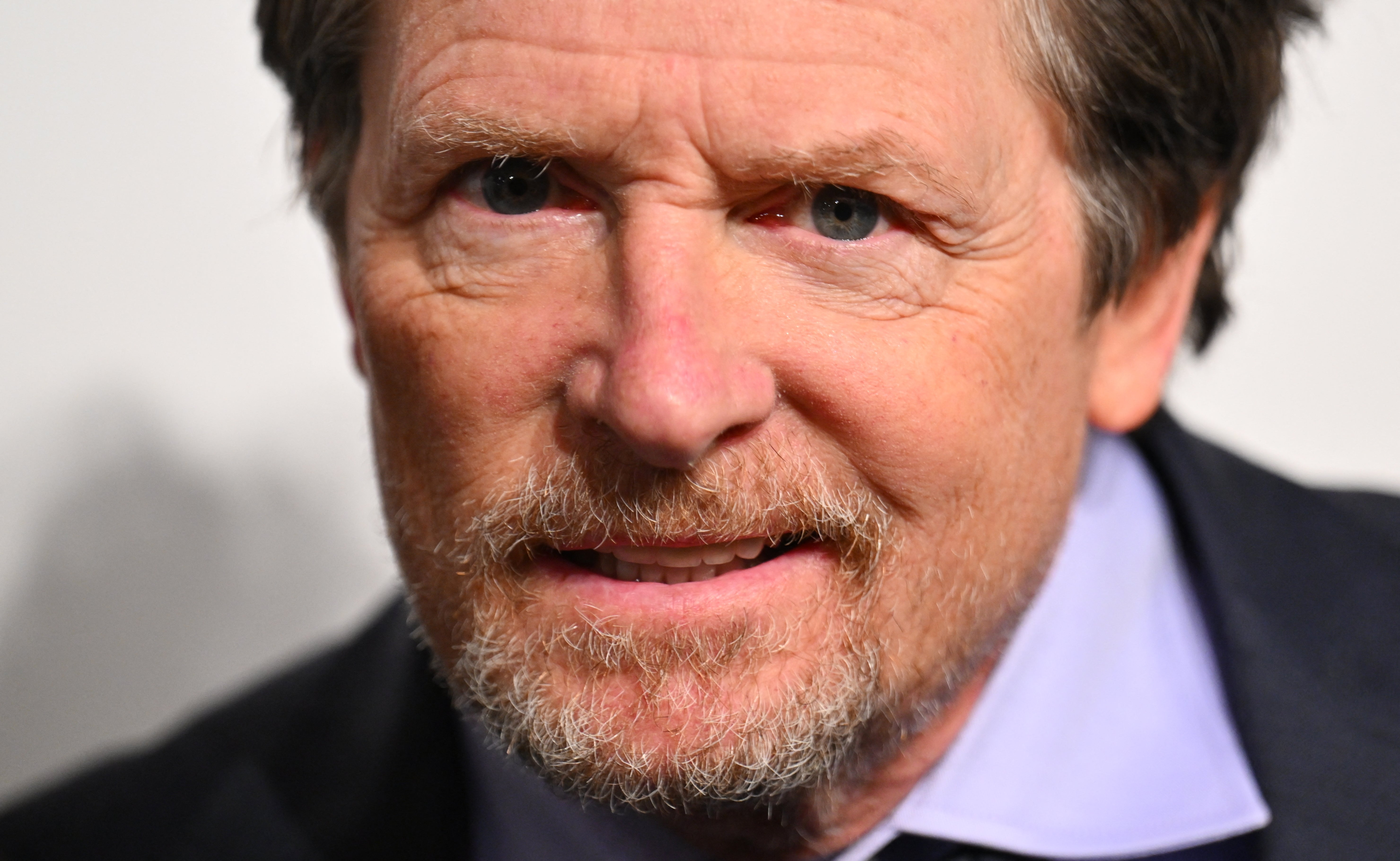 Many celebrities have received a diagnosis of Parkinson's disease, including actor Michael J. Fox and singer Neil Diamond. Some 90,000 people receive a condition diagnosis each year in the United States