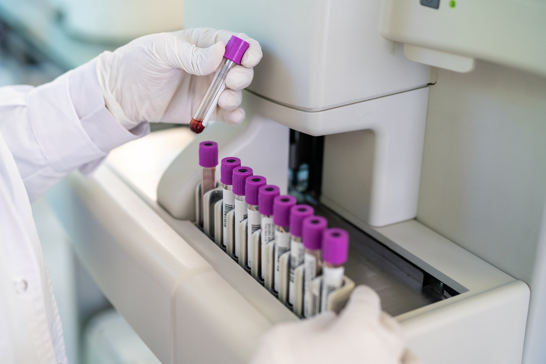 Advancements in microbiome research offer hope for earlier detection