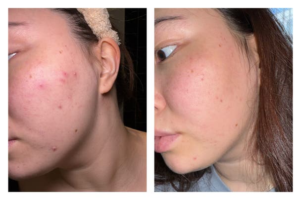 Medi8 C-Tetra advanced review 