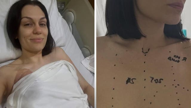 <p>Jessie J shares tearful update after undergoing breast cancer surgery</p>
