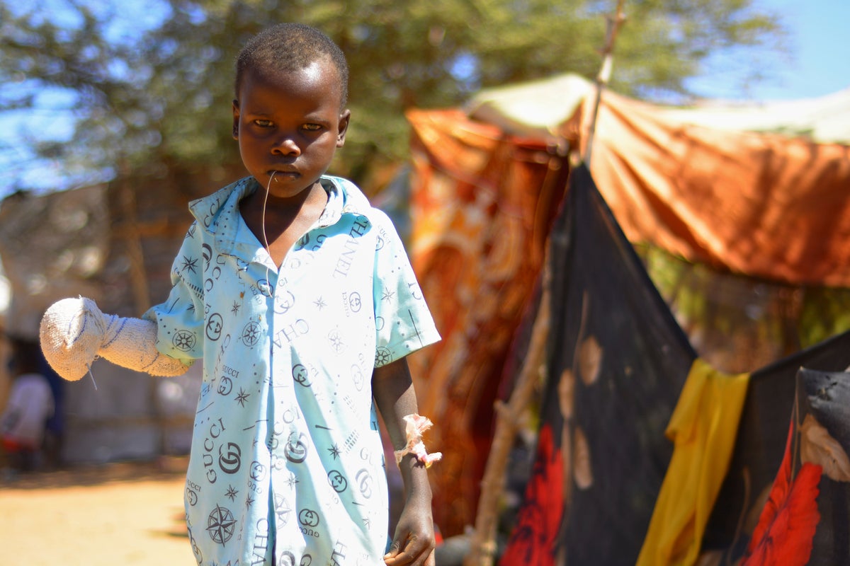 Starving Sudanese people eating weeds to survive amid brutal war