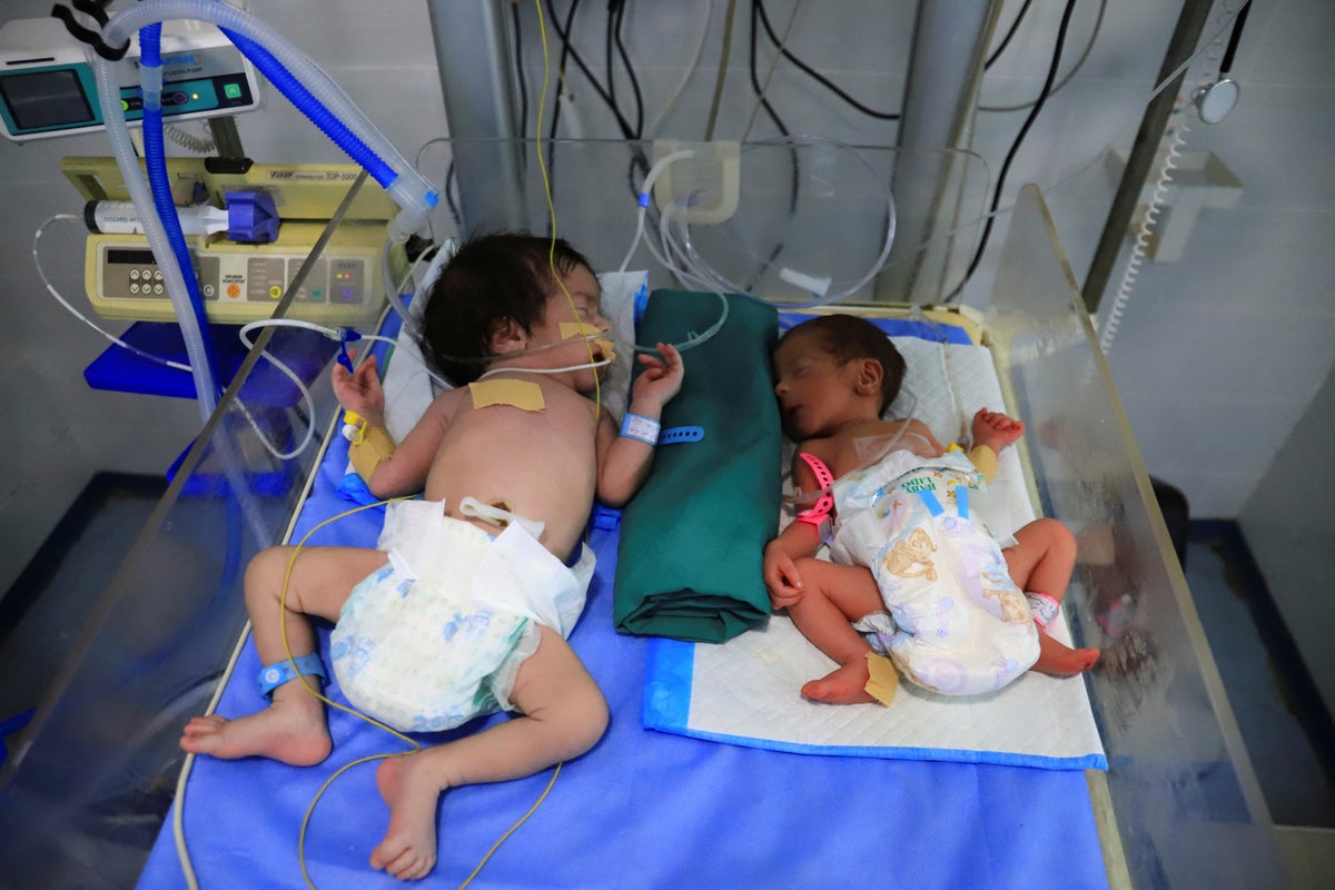 Starvation crisis caused by Israeli war and aid blockade kills at least 66 children in Gaza
