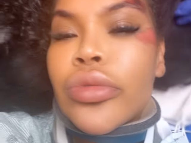 ‘Big Brother’ star Charley Uchea ‘left for dead’ after car crash