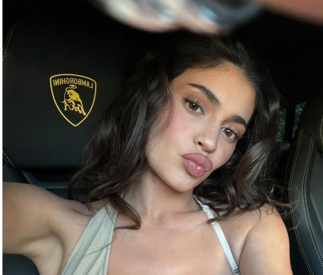 <p>Kylie Jenner, her sister Khloe Kardashian and their mother Kris Jenner, have all dished out details about their surgery treatments in recent weeks</p>