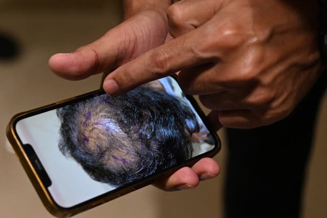 <p>Representational photo</p>