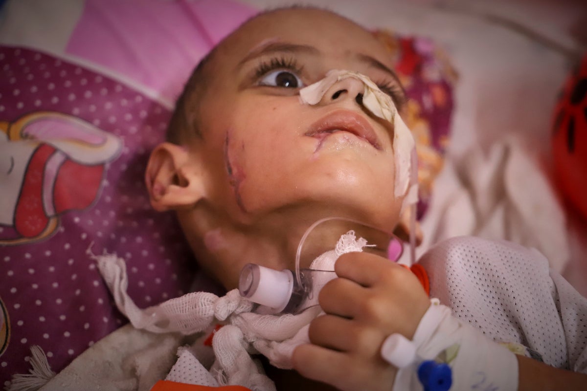 A boy in Gaza with brain damage fights for his life amid blockade