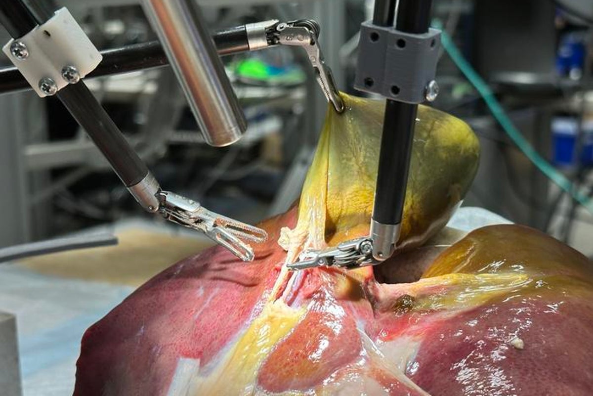A robot might perform your next surgery