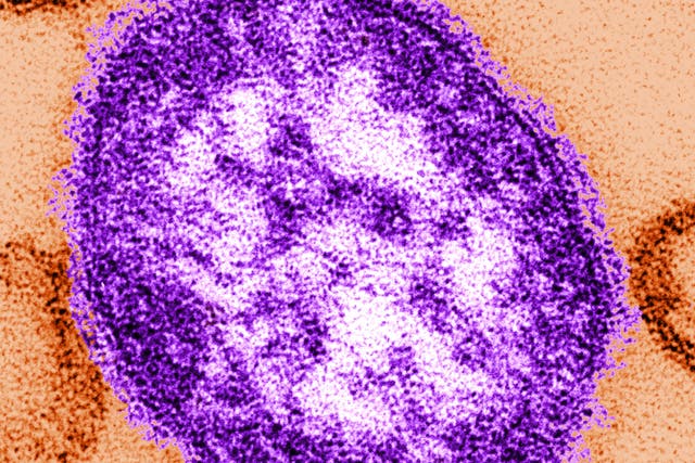 <p>Hundreds of people could die from measles in England over the next 20 years</p>