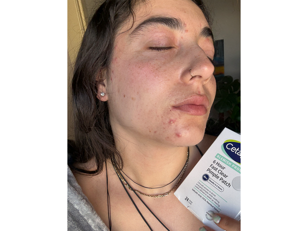 Best pimple patches IndyBest review Cetaphil gentle clear pimple patches