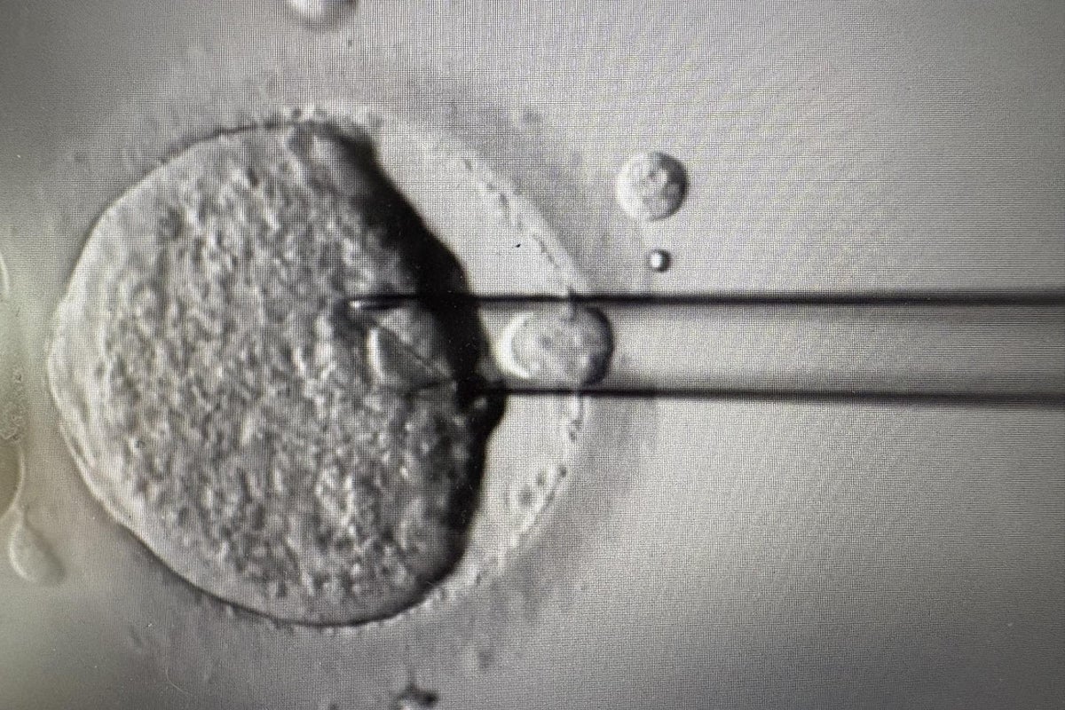 The IVF technique that created healthy babies from three sets of DNA