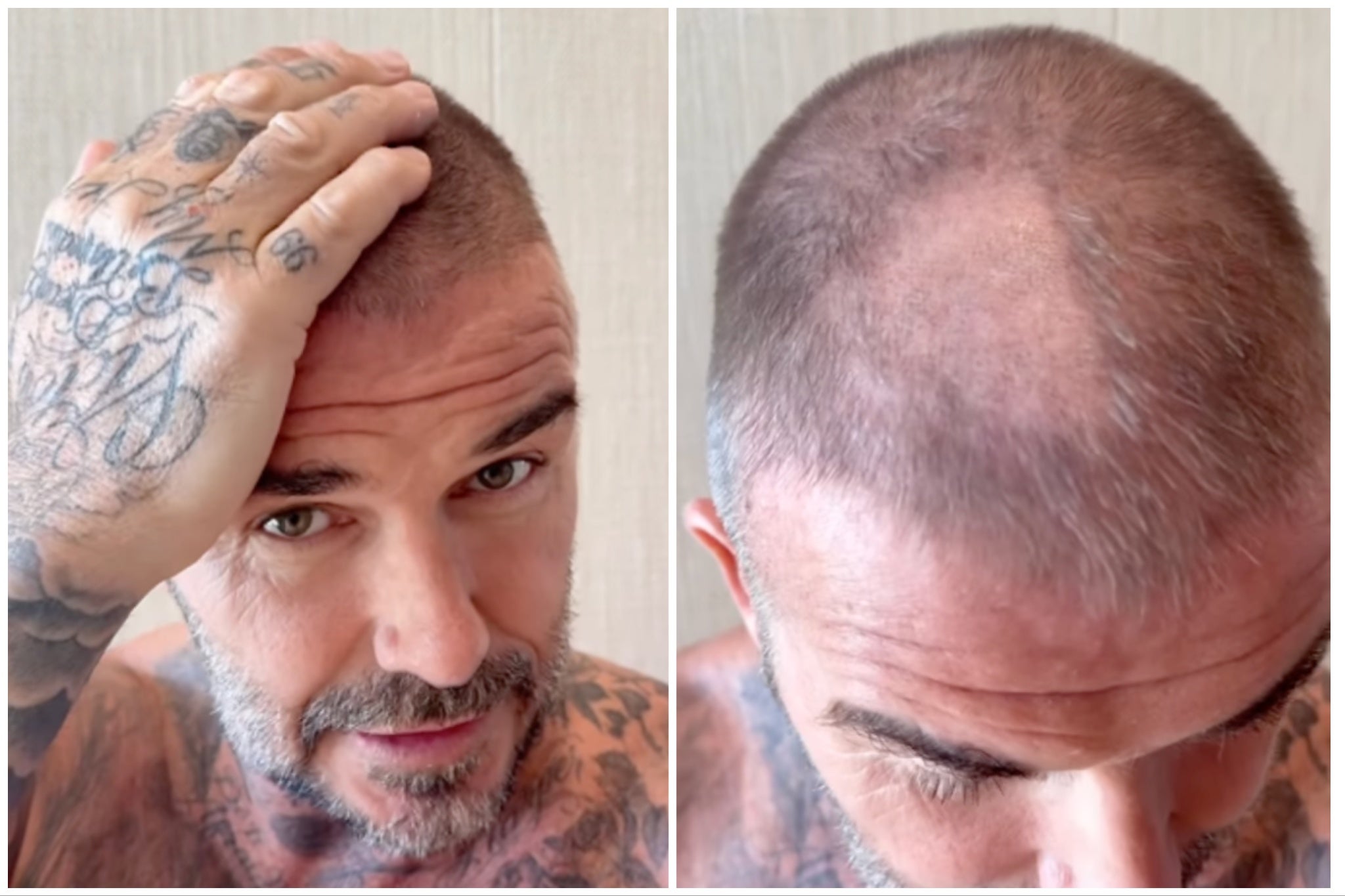 David Beckham has been left with a glaring bald patch on his iconic buzz cut