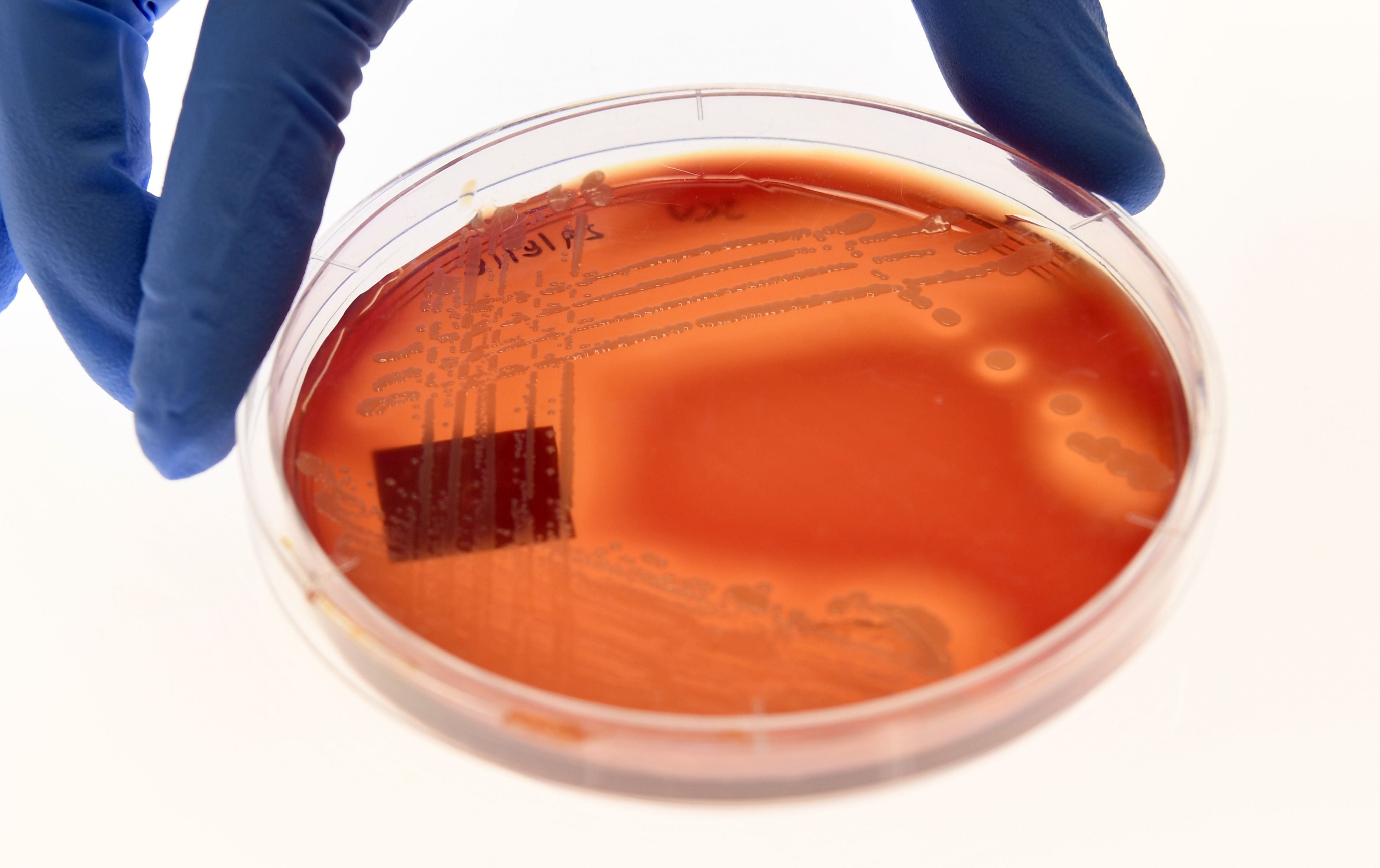 Superbug Staphylcocus epidermidis on an agar plate