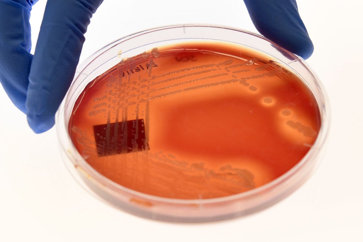Foreign aid cuts could lead to millions more dying from superbug infections by 2050, study warns
