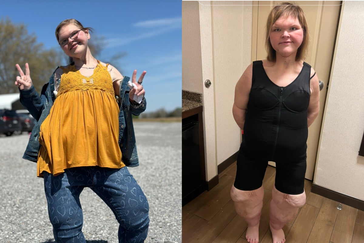 1000-Lb. Sisters star Tammy Slaton is unrecognizable in new photos after 500-pound weight loss 1000-Lb. Sisters star Tammy Slaton is unrecognizable in new photos after 500-pound weight loss