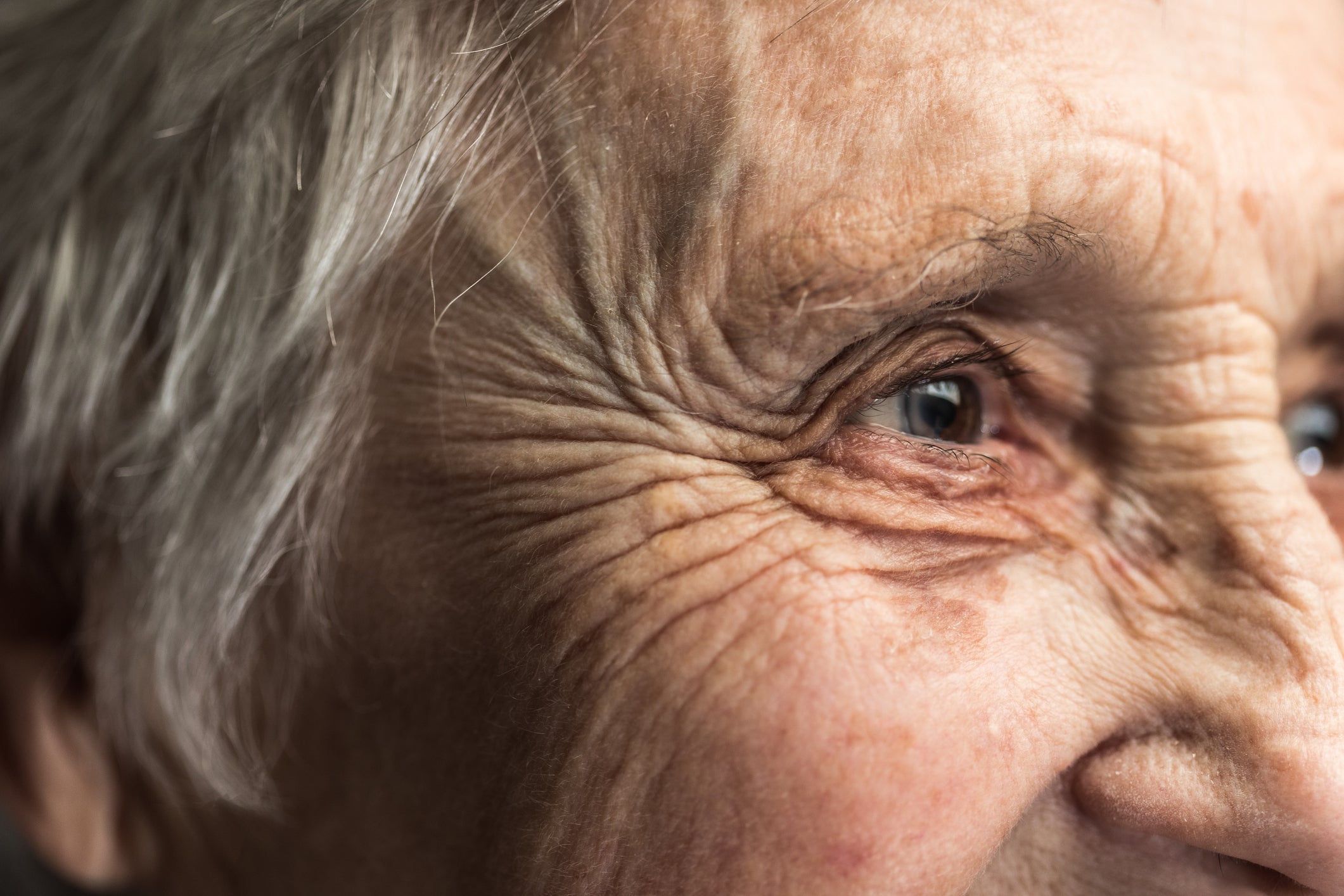 Researchers say they now know how wrinkles form as we age. The process is similar to stretching Silly Putty