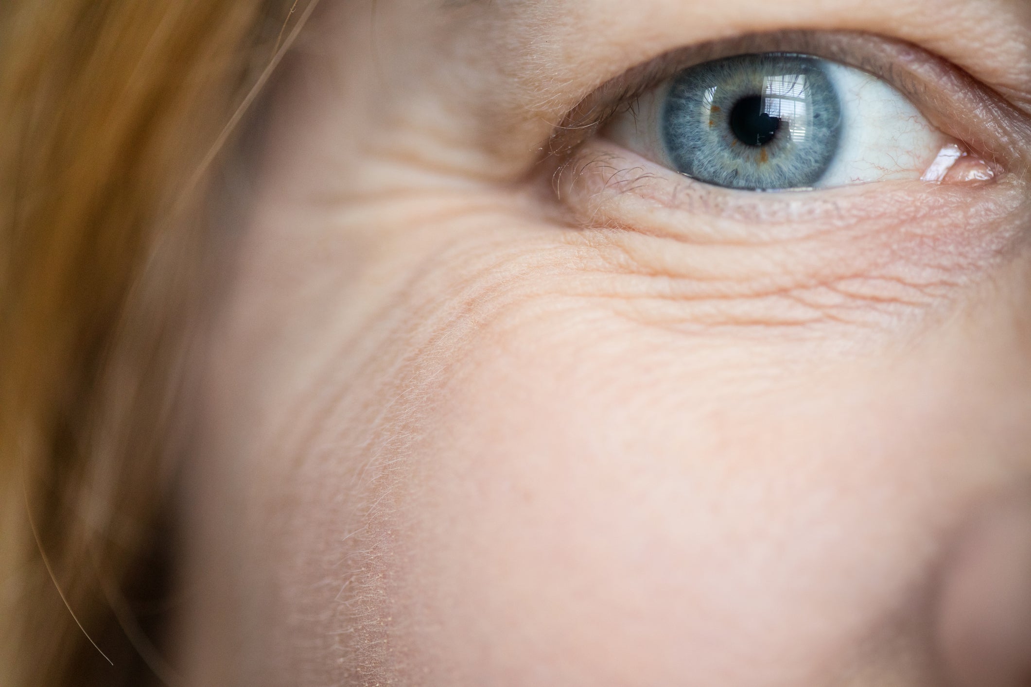 Associate Professor of Biomedical Engineering Guy German explained that there are inherent forces within the skin that drive wrinkle formation. He said the skin is actually already stretched a bit, and stretches more laterally over time