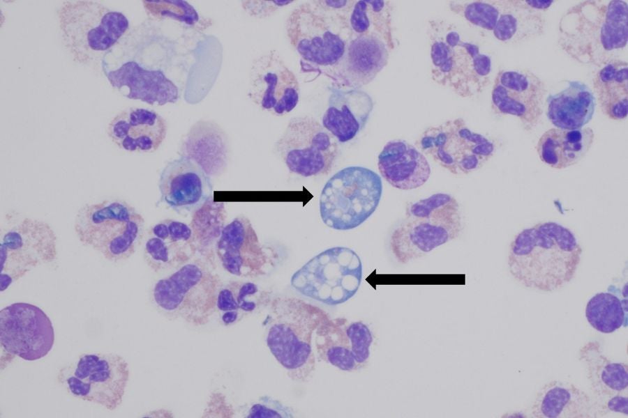 A child in southern Carlonina died of Naegleria Fowleri, also known as the brain eater amibe.