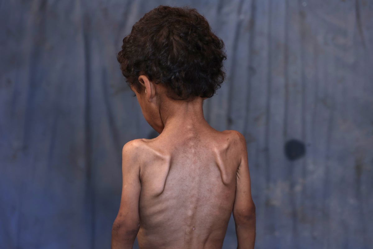 82 children starve to death in Gaza amid Israeli aid restrictions