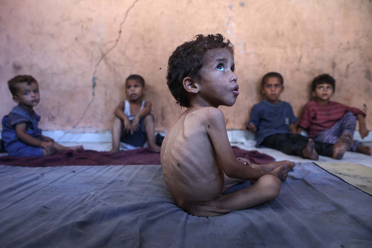 UN says one in five children in Gaza now malnourished