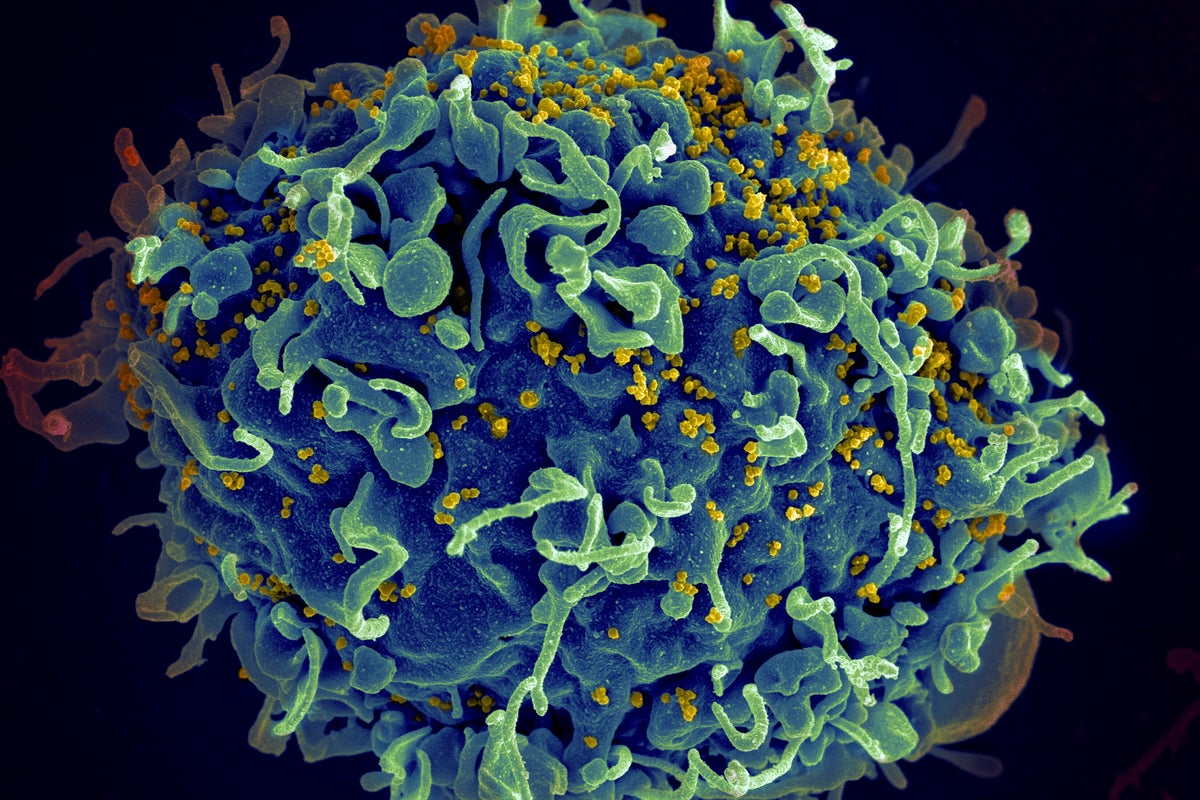 EU regulator approves injectable HIV drug that experts say could help stop transmission