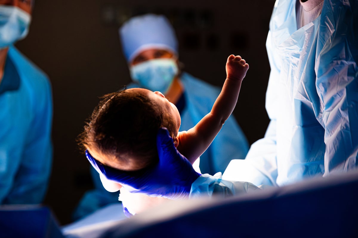 Picking up the newborn tab: These are the states where delivering your baby will cost the most