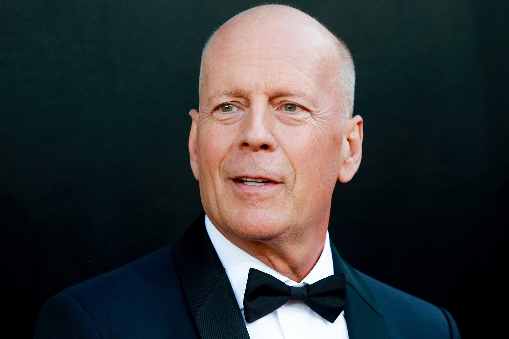 <p>Although Heming Willis still struggles with her husband’s diagnosis, she thinks the move was the right decision in order to help the couple’s two daughters maintain a more normal childhood, and for her own well-being.</p>