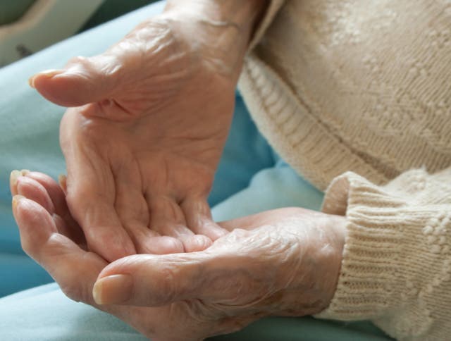 <p>Doctors discovered this anomaly in more than 100 older patients who went to the Minnesota clinic to receive treatment for a rare autoimmune disease known as giant cell arteritis. </p>