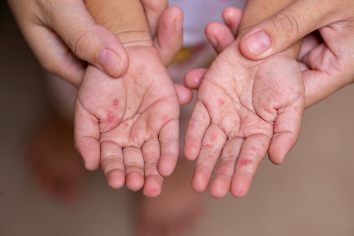 https://static.independent.co.uk/2025/07/31/19/48/iStock-1437267017.jpeg?trim=0,0,0,0&width=1200&height=800&crop=1200:800