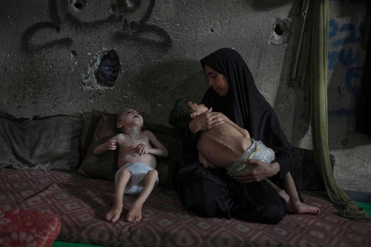 PHOTO ESSAY: Starvation attacks the bodies of these children in Gaza