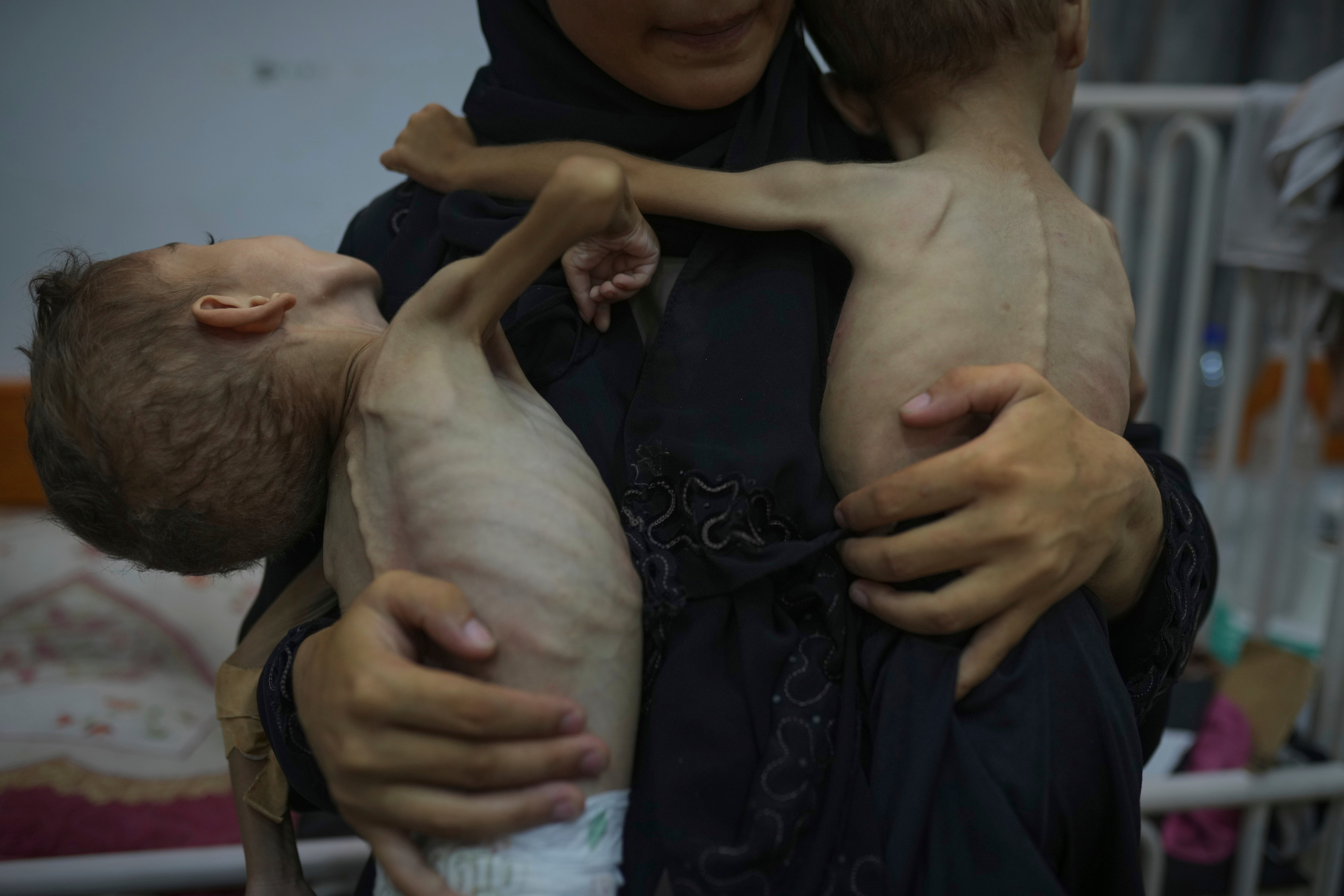 Omniya Mahra, holds shirtless for a photo her sons Oday, 4, left, and Mohammed, 3, who suffer from malnutrition and a genetic nerve disorder, at the Friends of the Patient Hospital in Gaza City, Tuesday, July 29, 2025