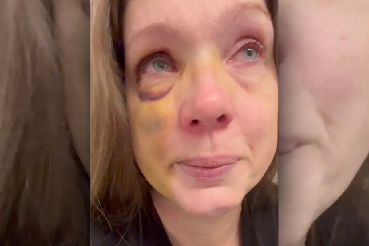 Mom knocked out in Cincinnati mob attack breaks silence after suffering ‘brain trauma’