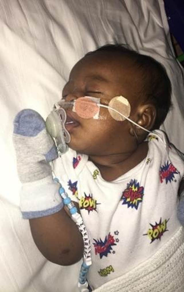 <p>Baby Zakariya Osman needed oxygen and a feeding tube</p>