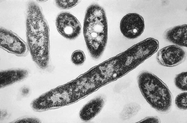 <p>Legionella pneumophila bacteria, responsible for causing Legionnaires' disease</p>