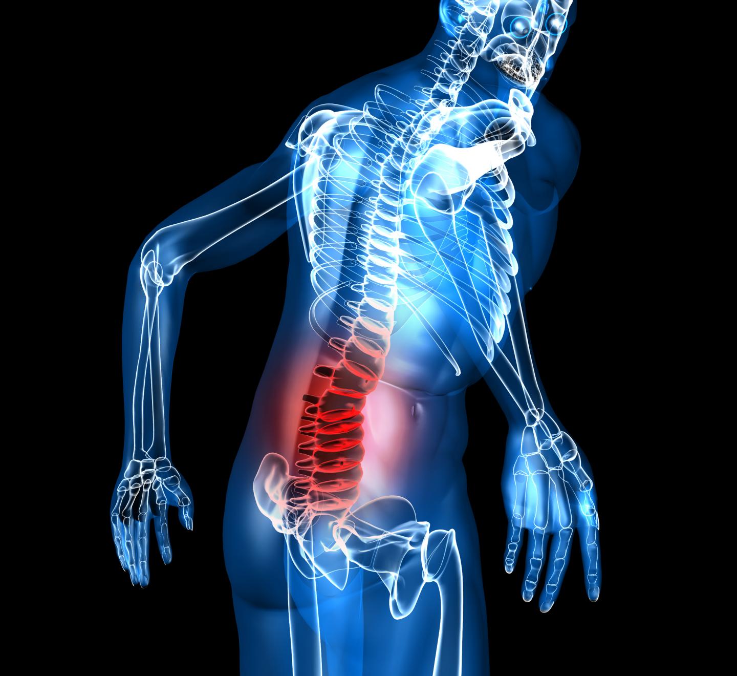 Low back pain