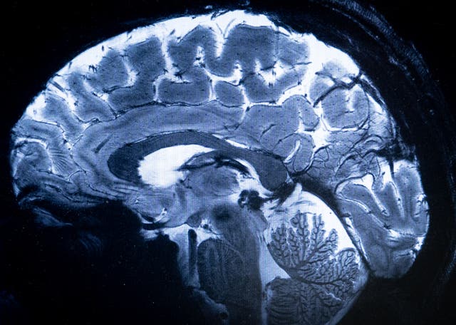 Brain scan image