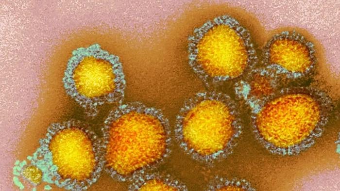 Electron microscope image of flu virus