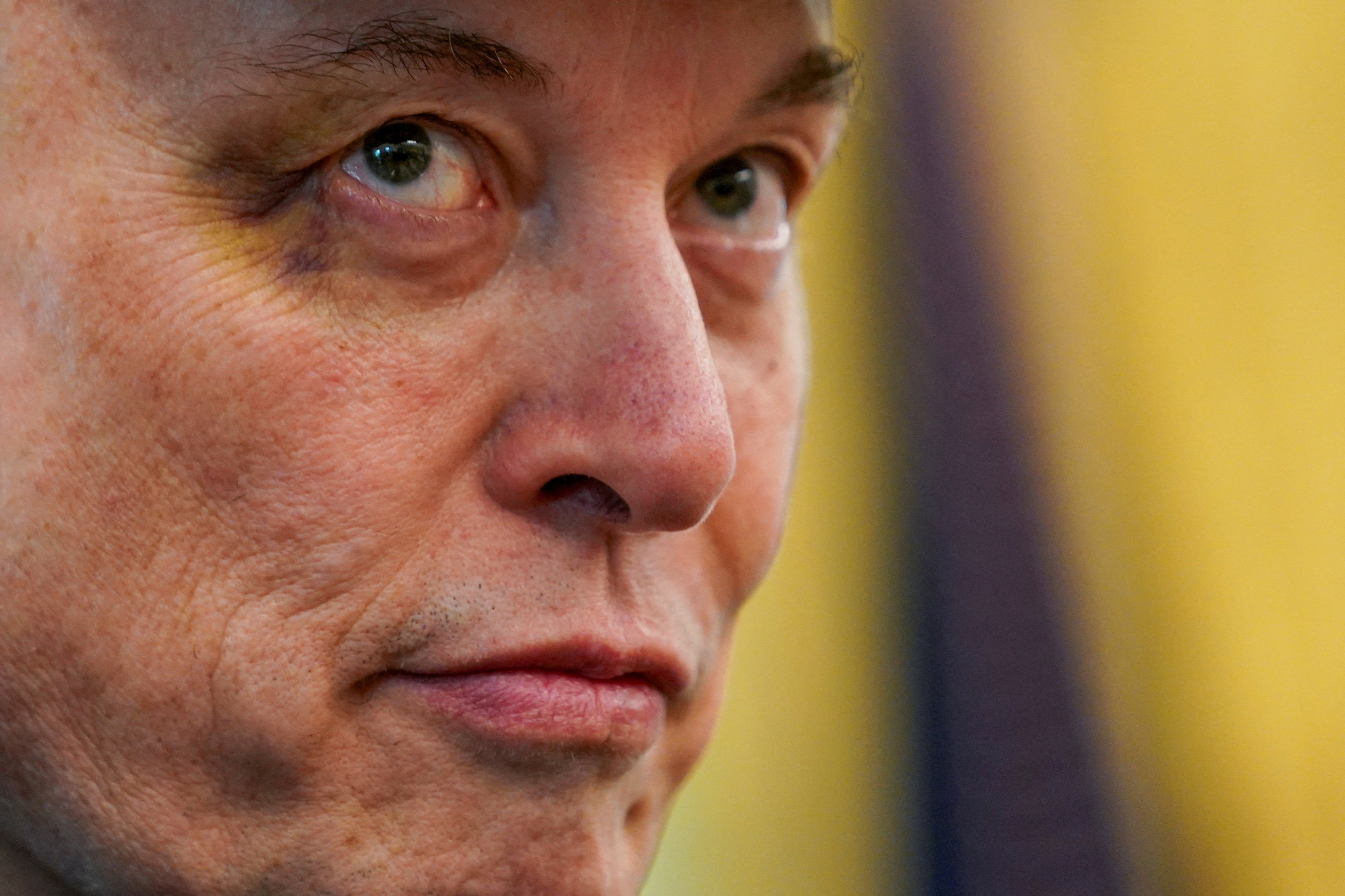 Elon Musk appeared in the Oval Office with a black eye earlier this year