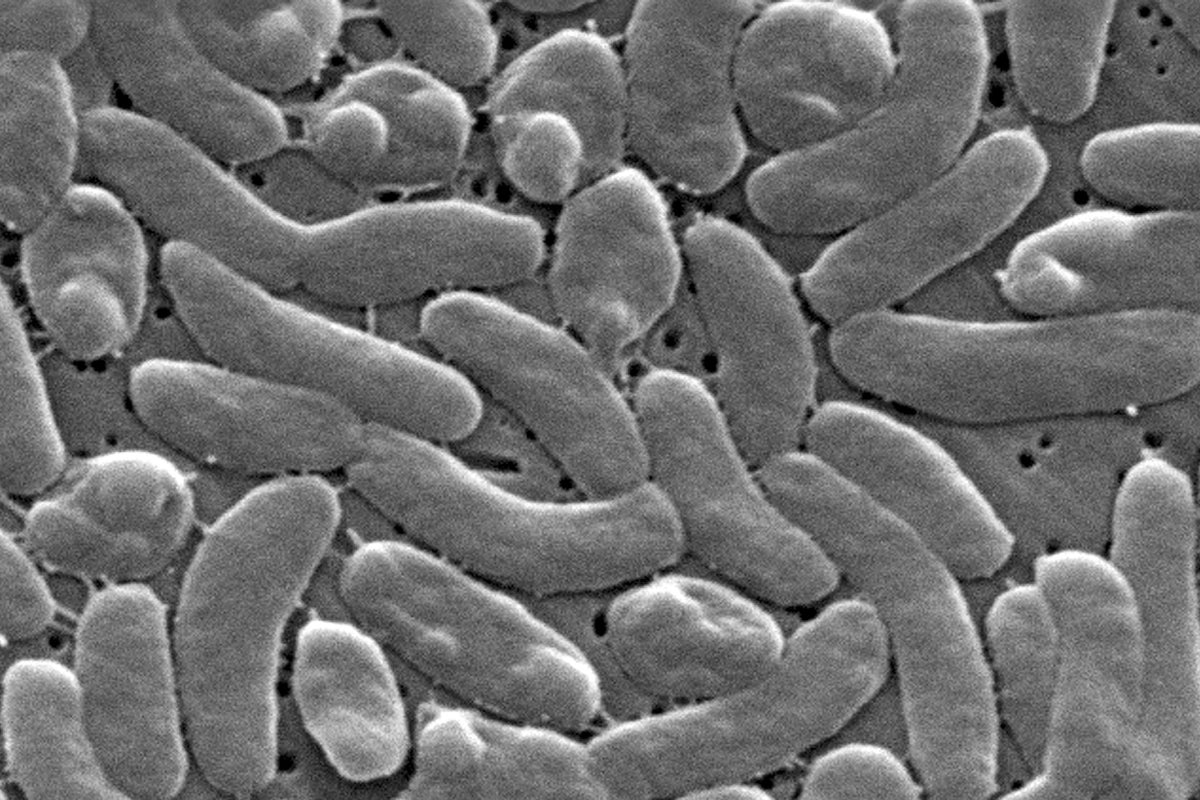 Florida Reports One Death and Twelve Infections from Vibrio Bacteria