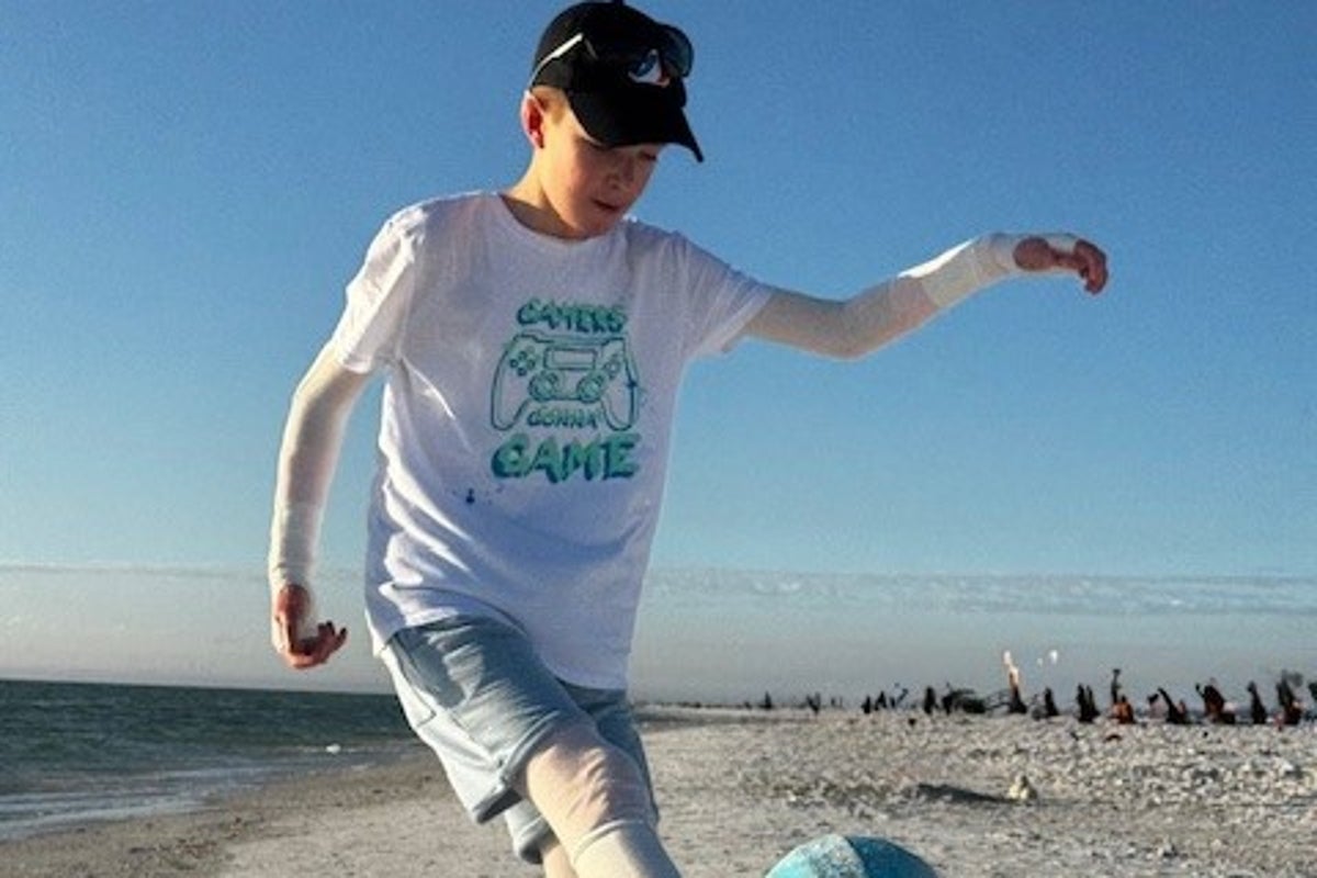 Boy, 12, with rare genetic skin disorder can now play football after breakthrough medical trial