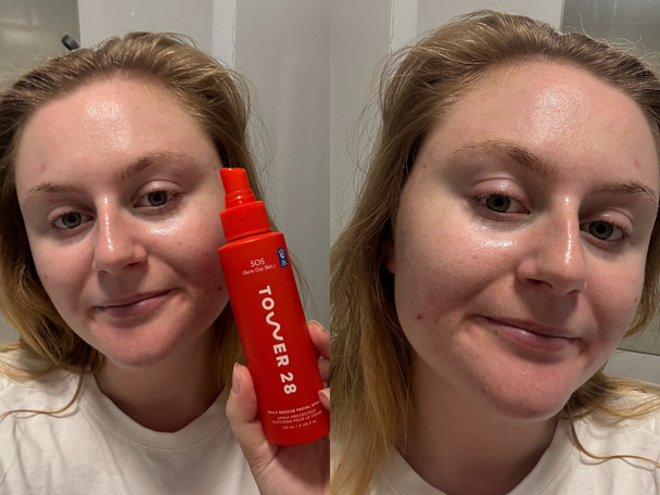 Indybest best hypochlorous acid spray Tower 28 SOS daily rescue facial spray